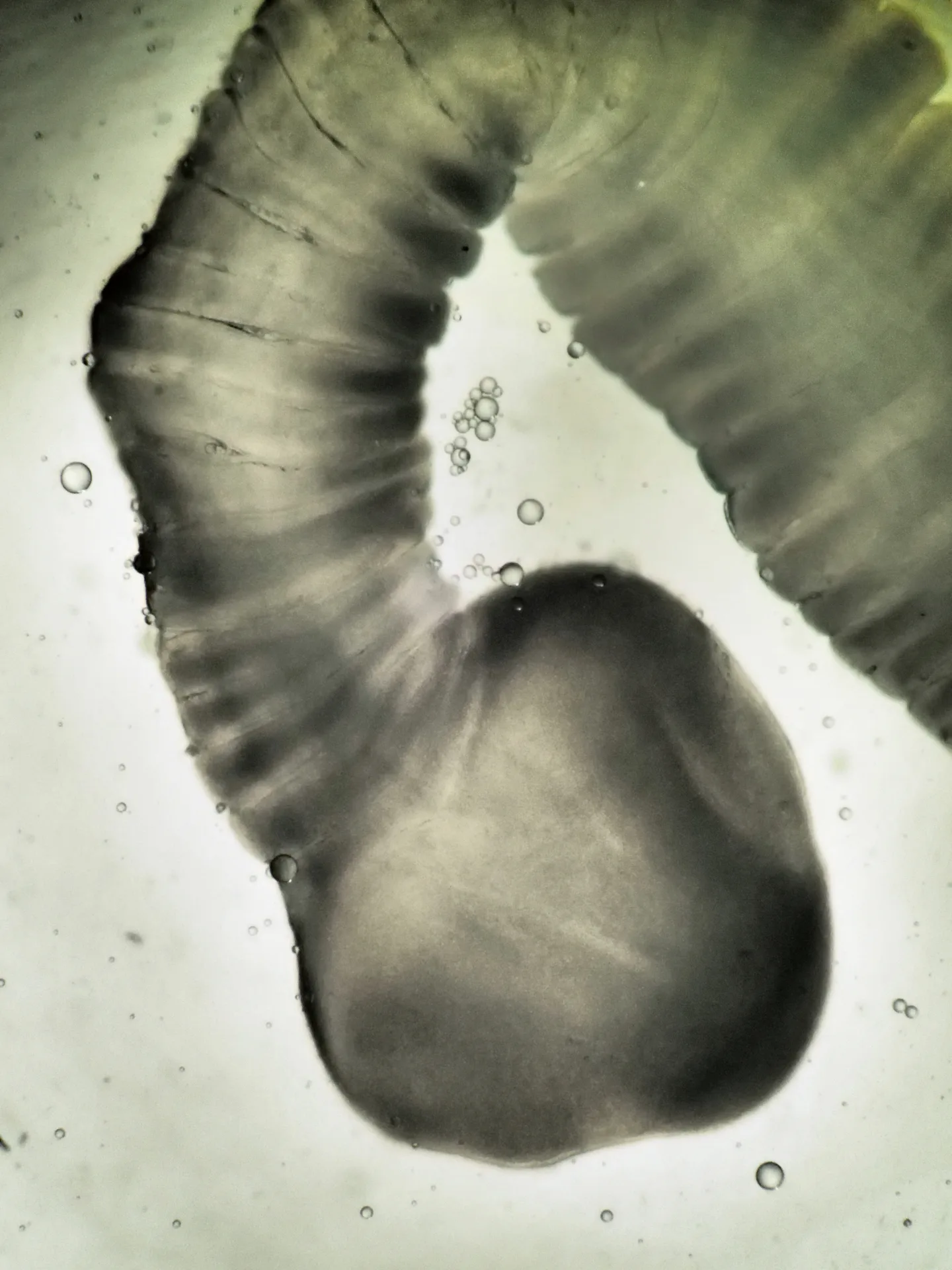 Scolex de Schyzocotyle acheilognathi observé au microscope