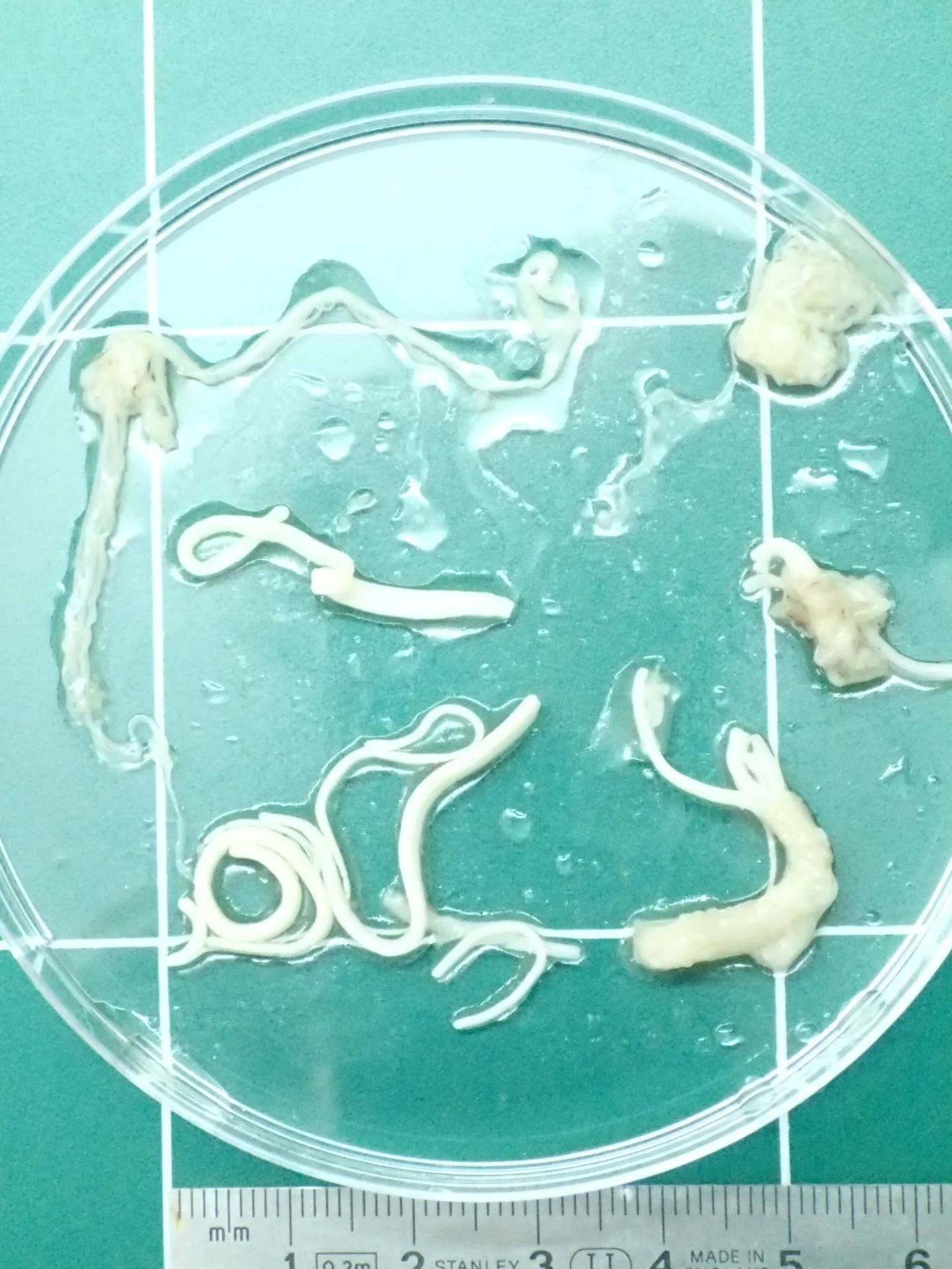 Cestodes adultes historiquement identifiés comme Bothriocephalus acheilognathi, aujourd’hui Schyzocotyle acheilognathi
