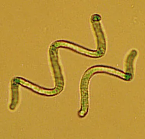 Filaments hélicoïdaux de cyanobactéries observés au microscope