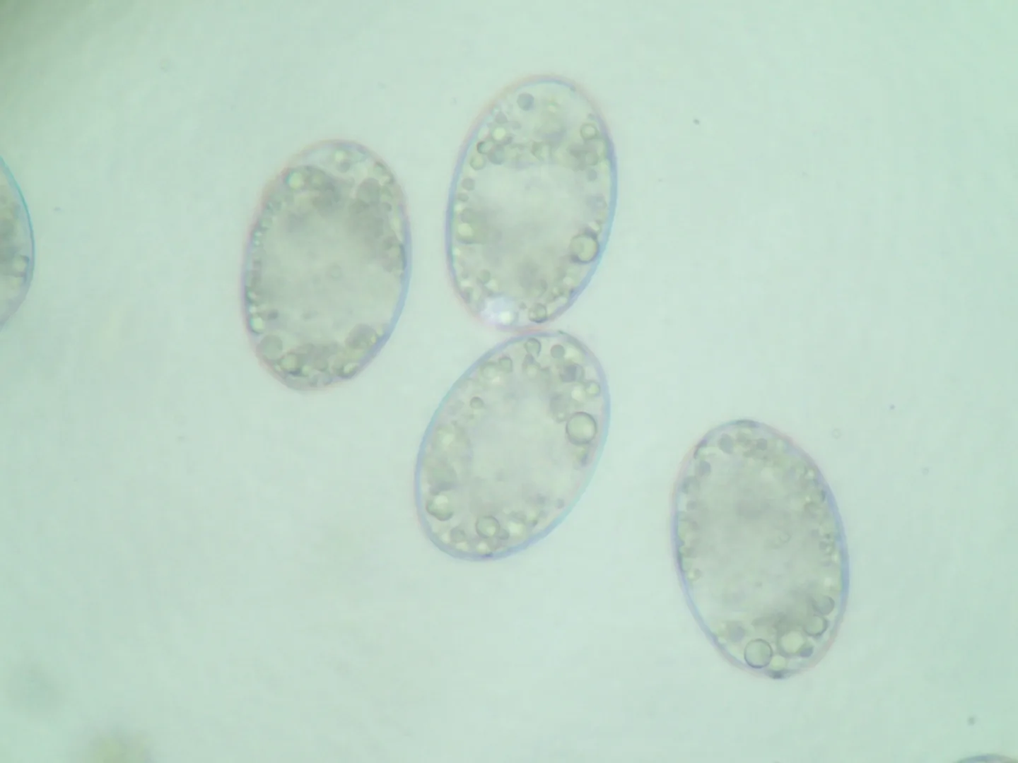 Œufs ovales de Schyzocotyle acheilognathi observés au microscope