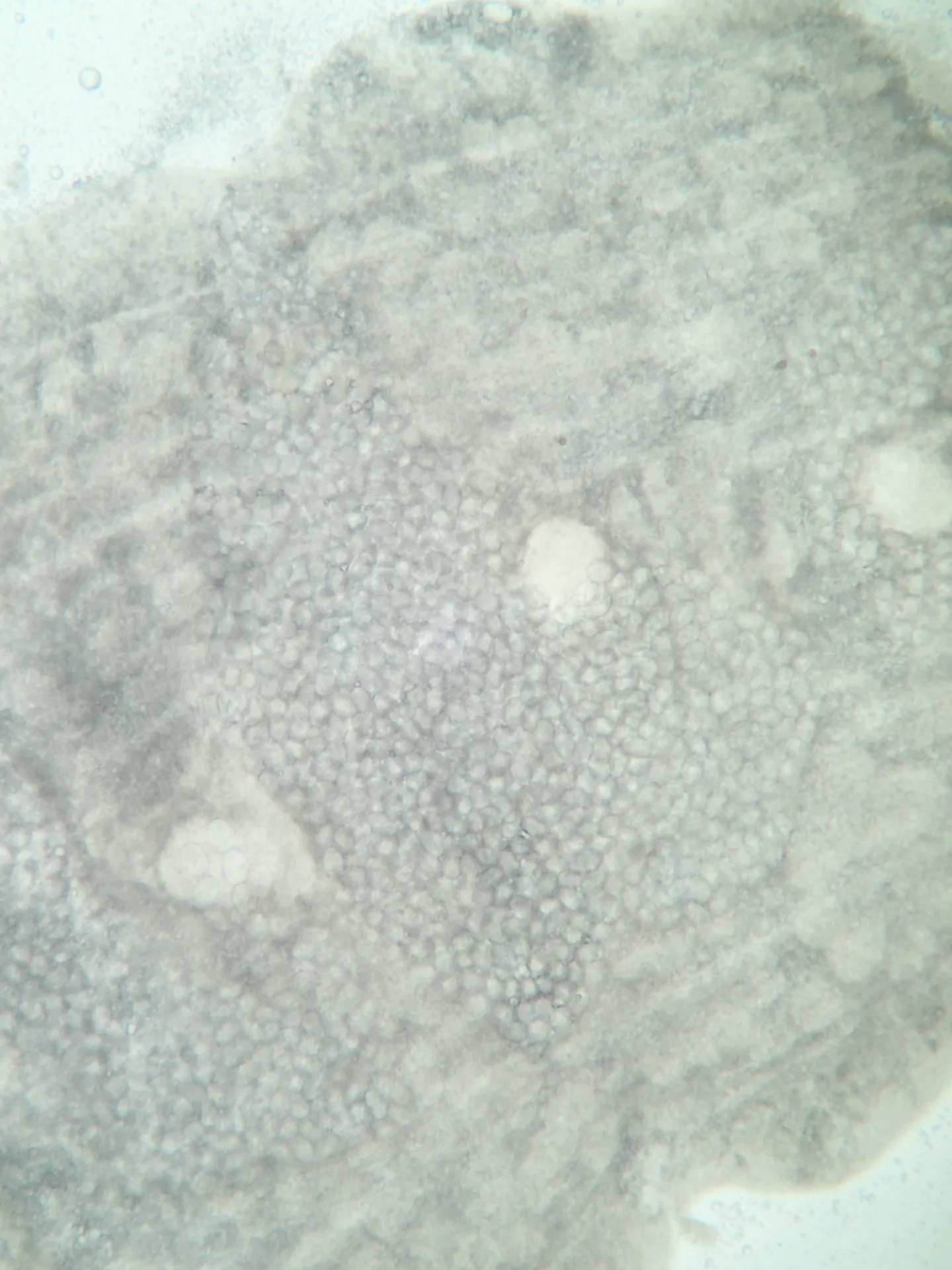 Détail microscopique d’un proglottis de Schyzocotyle acheilognathi