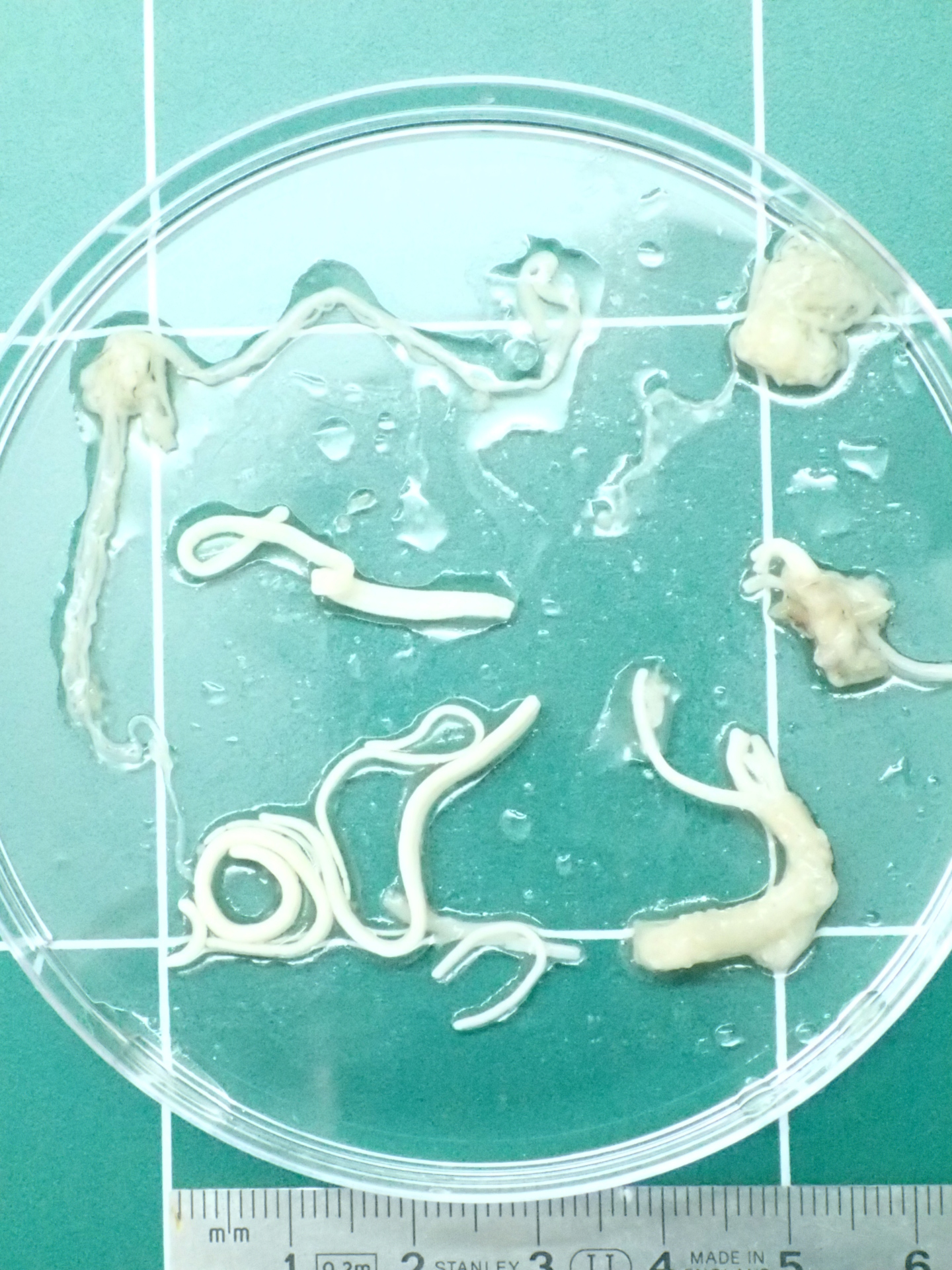Cestodes adultes historiquement identifiés comme Bothriocephalus acheilognathi, aujourd’hui Schyzocotyle acheilognathi