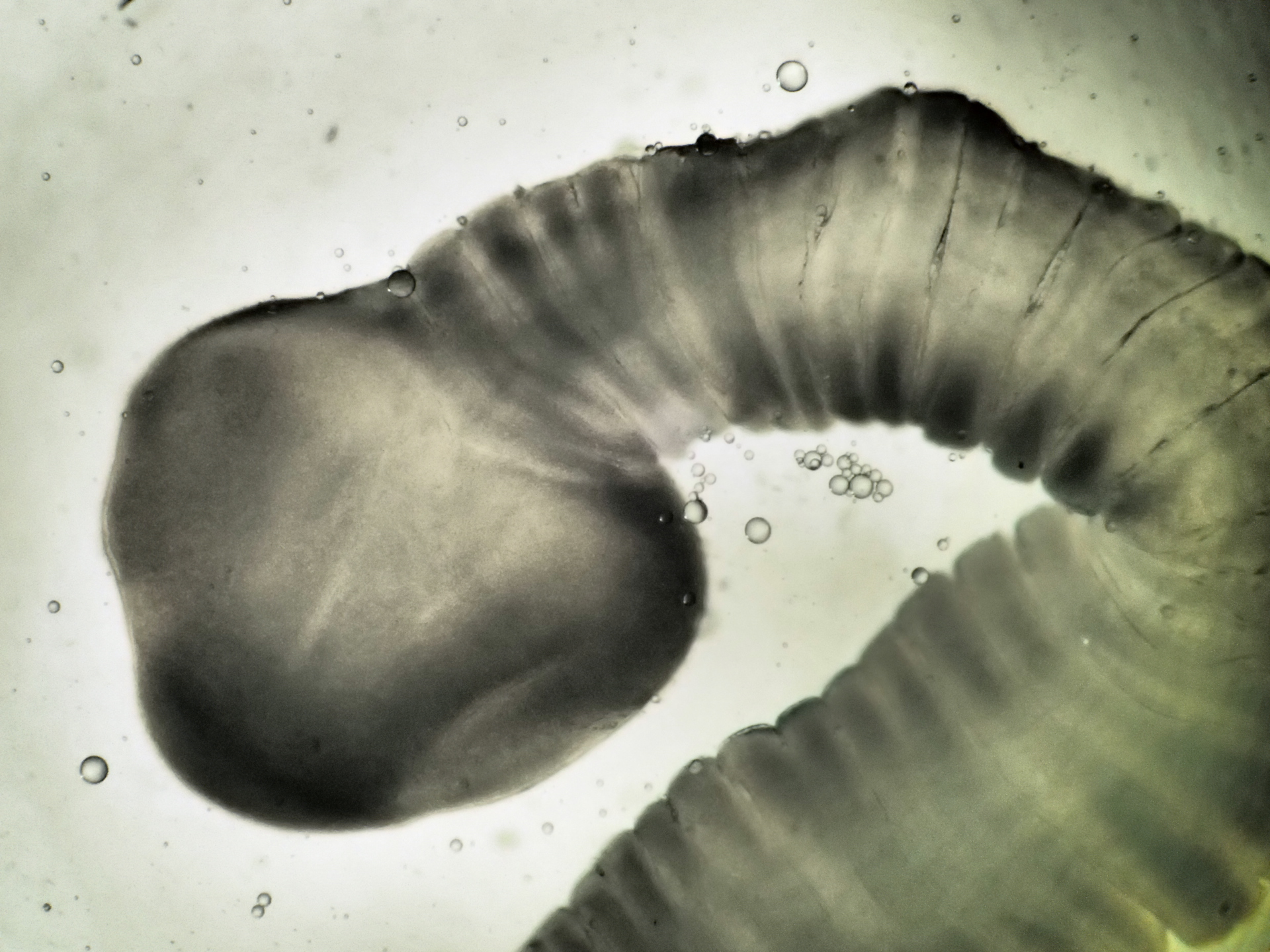 Scolex de Schyzocotyle acheilognathi observé au microscope