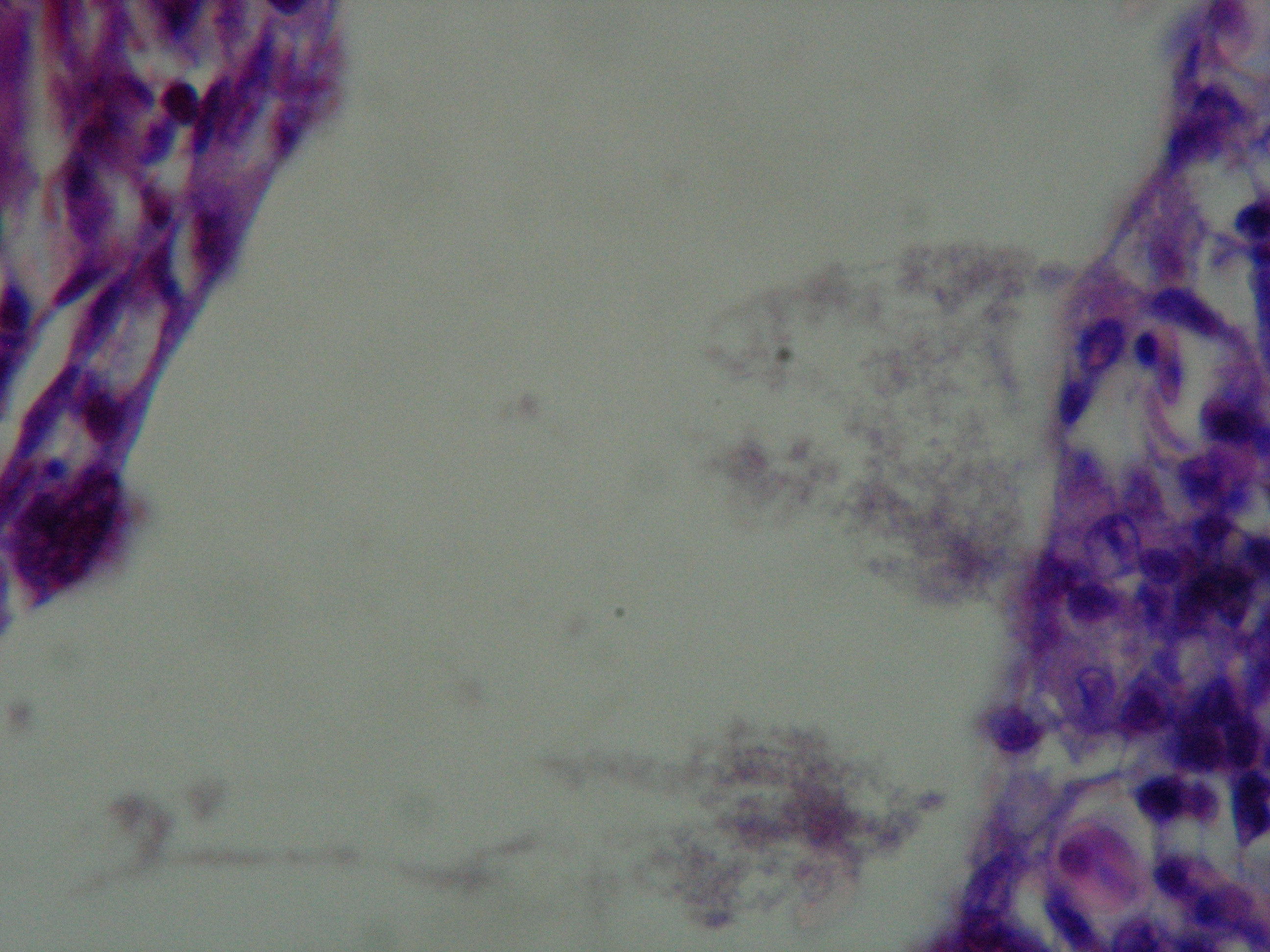 Columnariose