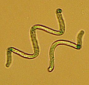Cyanobactérie