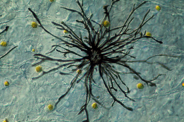 Mélanophore