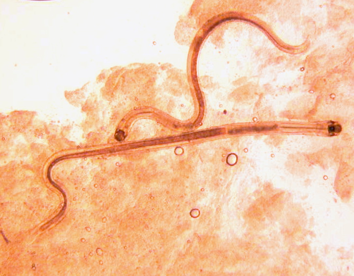 Nématode